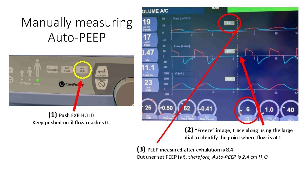 Manually measuring Auto-PEEP (1) Push EXP HOLD Keep pushed until flow reaches 0. (2)