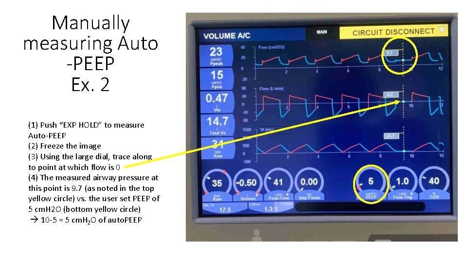 Manually measuring Auto -PEEP Ex. 2 (1) Push “EXP HOLD” to measure Auto-PEEP (2)