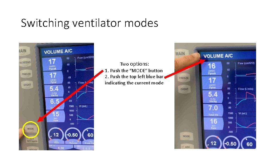 Switching ventilator modes Two options: 1. Push the “MODE” button 2. Push the top
