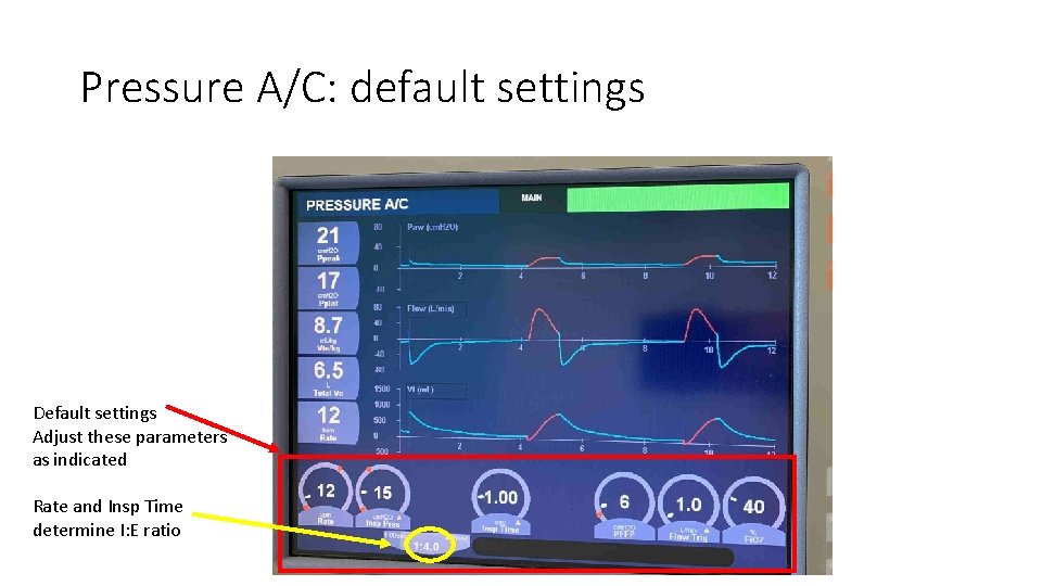 Pressure A/C: default settings Default settings Adjust these parameters as indicated Rate and Insp