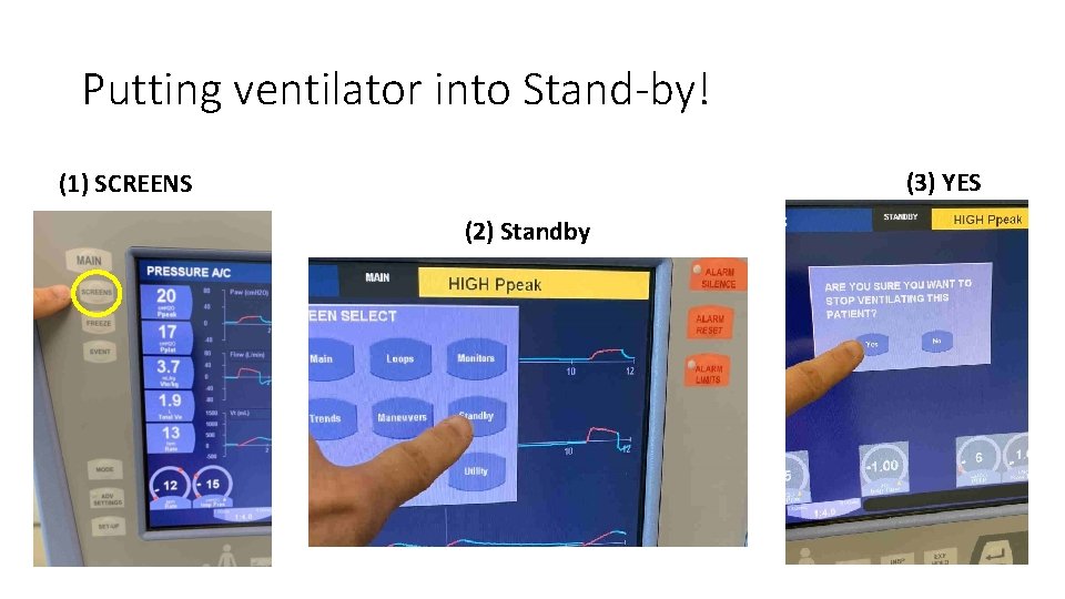 Putting ventilator into Stand-by! (3) YES (1) SCREENS (2) Standby 