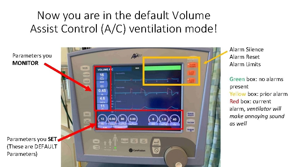 Now you are in the default Volume Assist Control (A/C) ventilation mode! Parameters you
