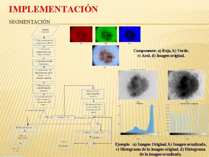 IMPLEMENTACIÓN SEGMENTACIÓN Componente: a) Roja, b) Verde, c) Azul, d) Imagen original. Ejemplo :