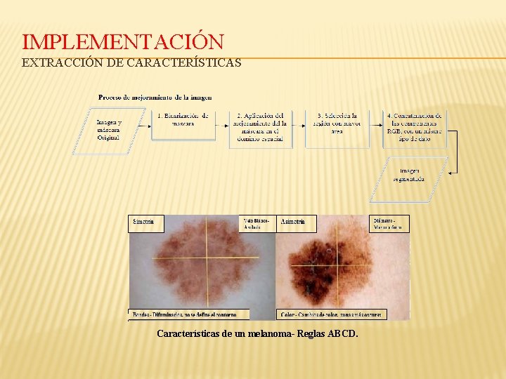 IMPLEMENTACIÓN EXTRACCIÓN DE CARACTERÍSTICAS Características de un melanoma- Reglas ABCD. 