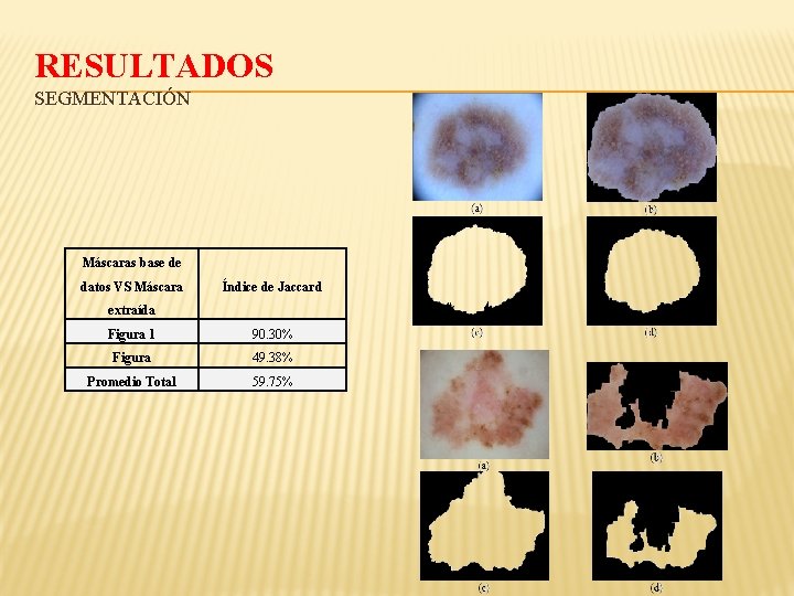 RESULTADOS SEGMENTACIÓN Máscaras base de datos VS Máscara Índice de Jaccard extraída Figura 1