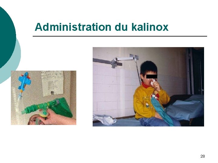 Administration du kalinox 28 