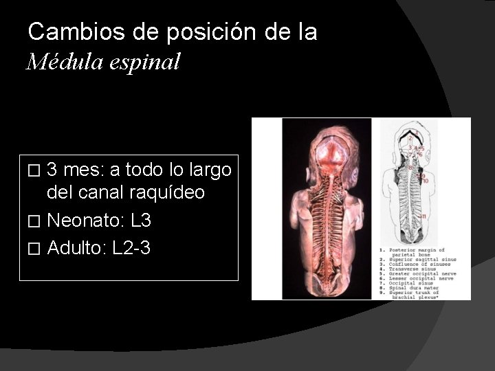 Cambios de posición de la Médula espinal 3 mes: a todo lo largo del