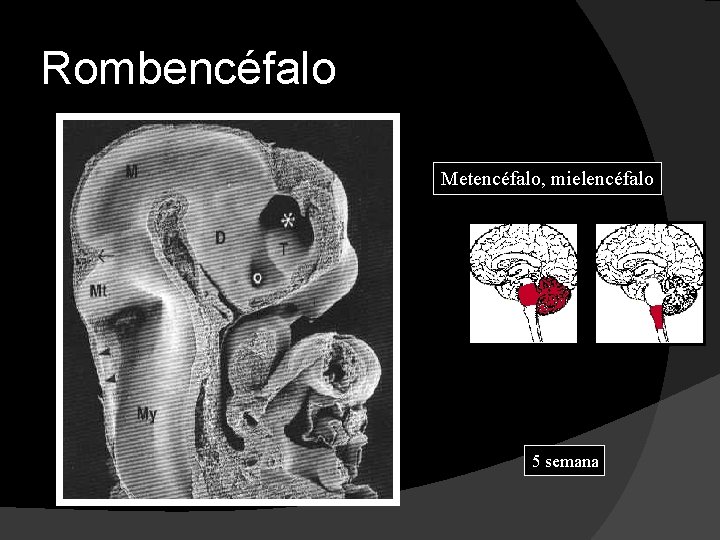 Rombencéfalo Metencéfalo, mielencéfalo 5 semana 