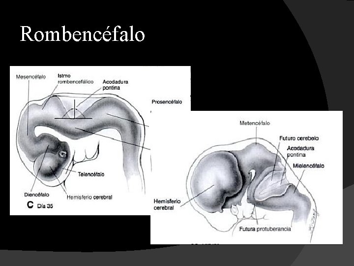 Rombencéfalo 