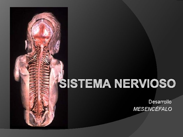 SISTEMA NERVIOSO Desarrollo MESENCÉFALO 