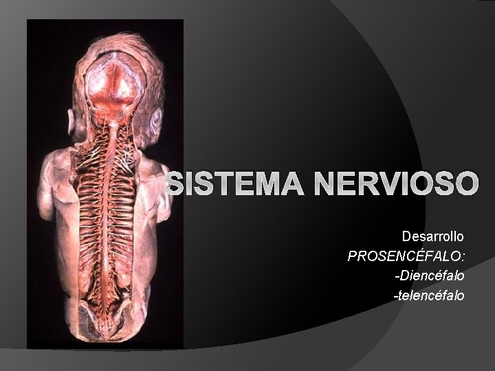 SISTEMA NERVIOSO Desarrollo PROSENCÉFALO: -Diencéfalo -telencéfalo 