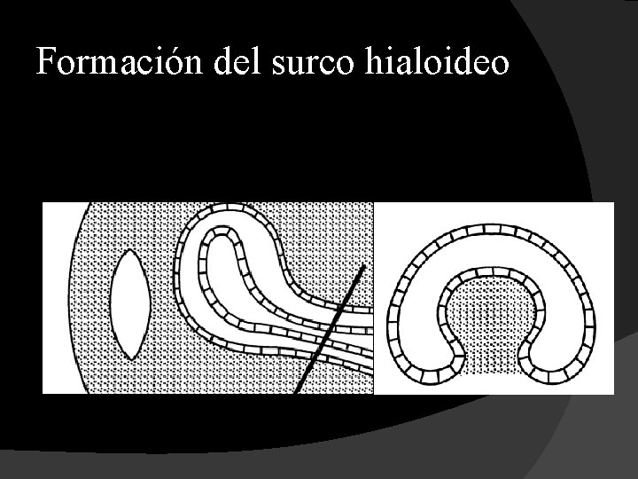 Formación del surco hialoideo 