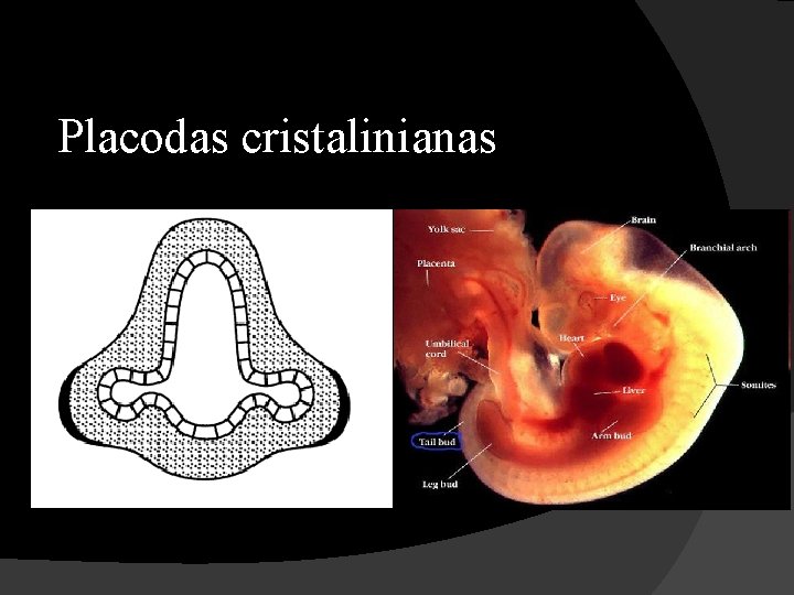 Placodas cristalinianas 