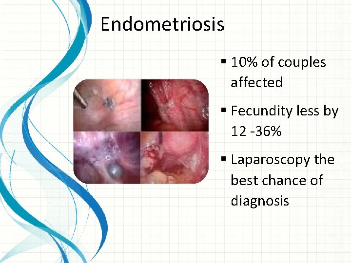 Endometriosis § 10% of couples affected § Fecundity less by 12 -36% § Laparoscopy