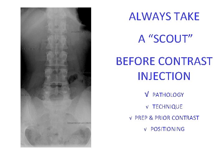 ALWAYS TAKE A “SCOUT” BEFORE CONTRAST INJECTION √ PATHOLOGY √ TECHNIQUE √ PREP & ALWAYS TAKE A “SCOUT” BEFORE CONTRAST INJECTION √ PATHOLOGY √ TECHNIQUE √ PREP &
