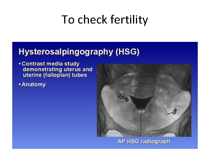 To check fertility To check fertility
