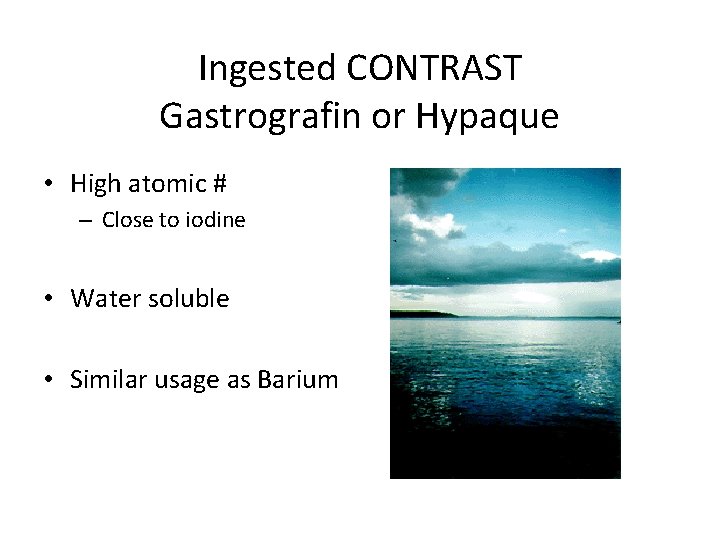 Ingested CONTRAST Gastrografin or Hypaque • High atomic # – Close to iodine •