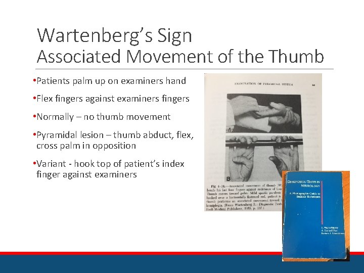 Wartenberg’s Sign Associated Movement of the Thumb • Patients palm up on examiners hand
