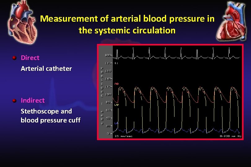 Measurement of arterial blood pressure in the systemic circulation Direct Arterial catheter Indirect Stethoscope