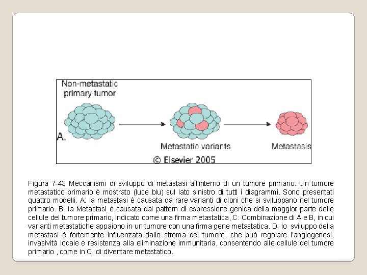 Figura 7 -43 Meccanismi di sviluppo di metastasi all'interno di un tumore primario. Un Figura 7 -43 Meccanismi di sviluppo di metastasi all'interno di un tumore primario. Un