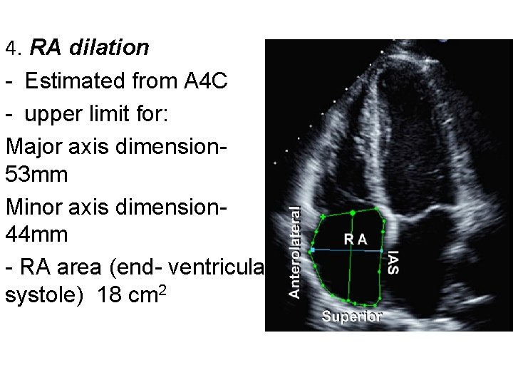 4. RA dilation - Estimated from A 4 C - upper limit for: Major