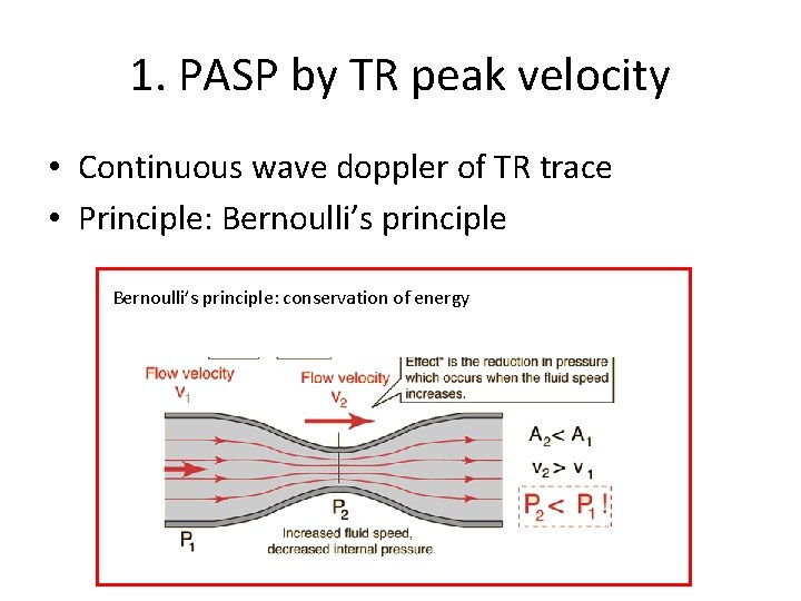 1. PASP by TR peak velocity • Continuous wave doppler of TR trace •