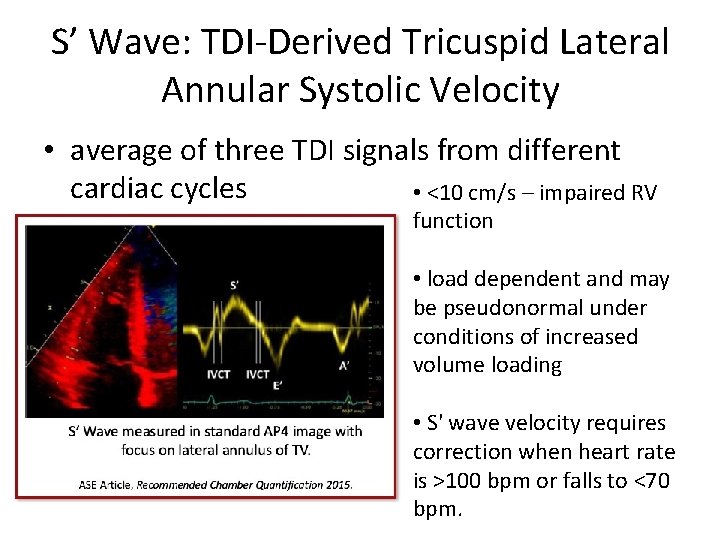 S’ Wave: TDI-Derived Tricuspid Lateral Annular Systolic Velocity • average of three TDI signals
