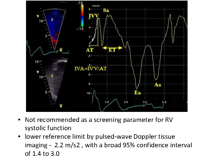  • Not recommended as a screening parameter for RV systolic function • lower