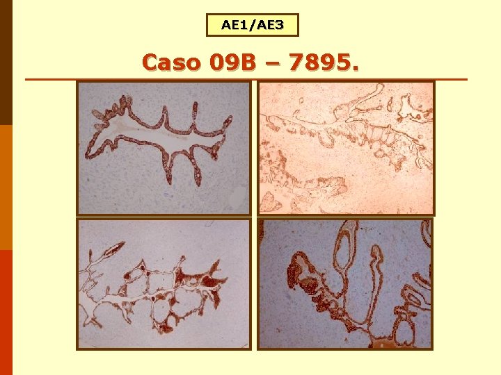 AE 1/AE 3 Caso 09 B – 7895. AE 1/AE 3 Caso 09 B – 7895.
