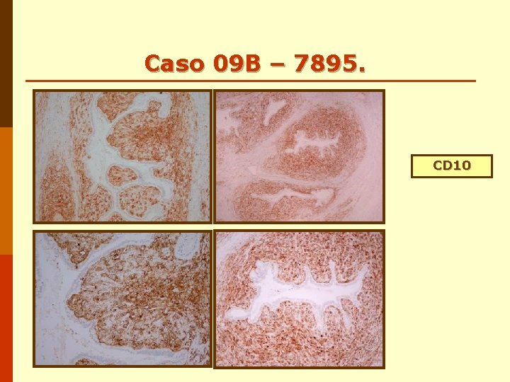 Caso 09 B – 7895. CD 10 Caso 09 B – 7895. CD 10
