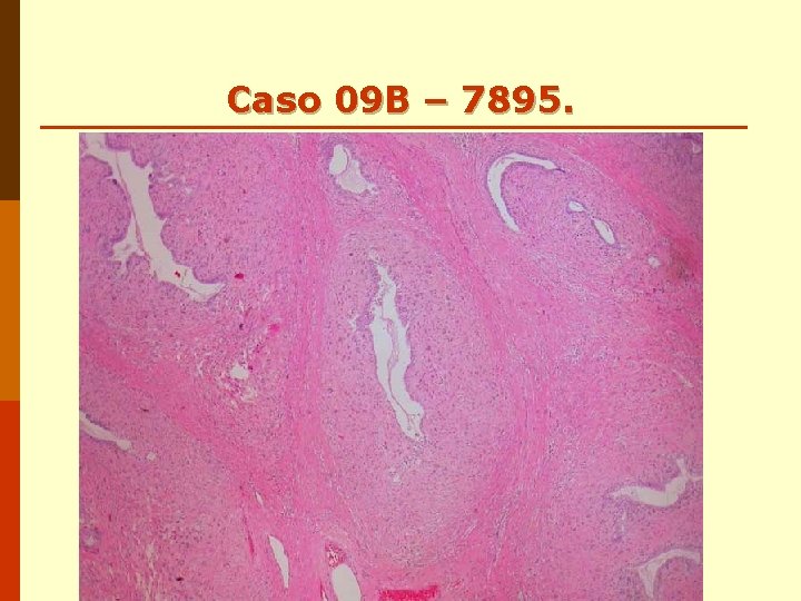 Caso 09 B – 7895. Caso 09 B – 7895.