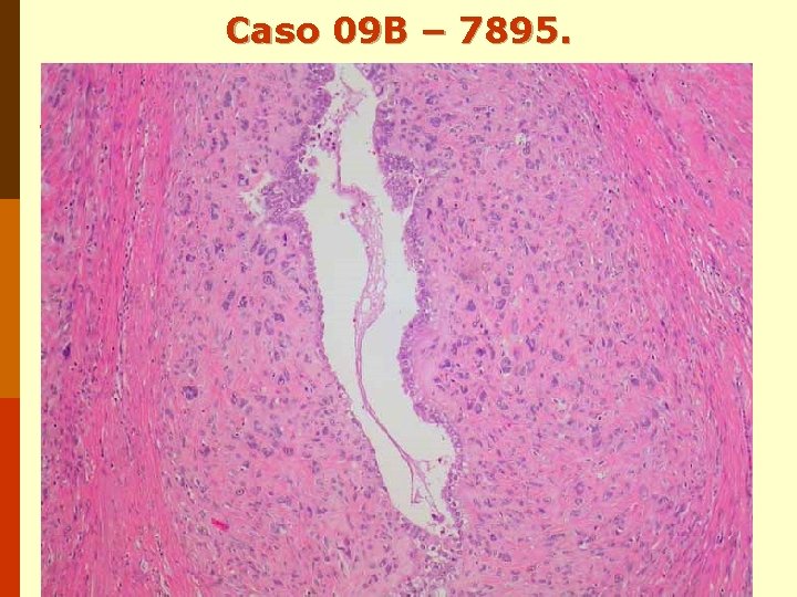 Caso 09 B – 7895. Caso 09 B – 7895.