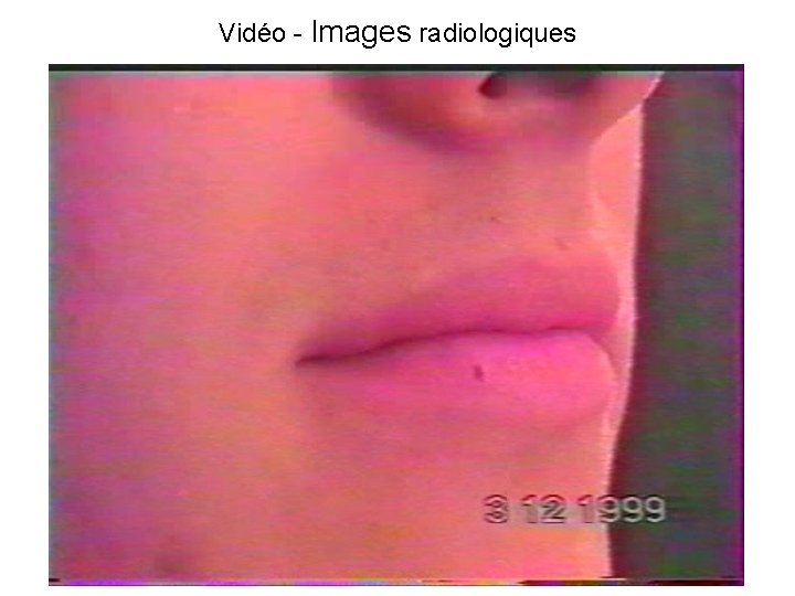 Vidéo - Images radiologiques 