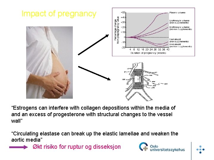 Impact of pregnancy “Estrogens can interfere with collagen depositions within the media of and