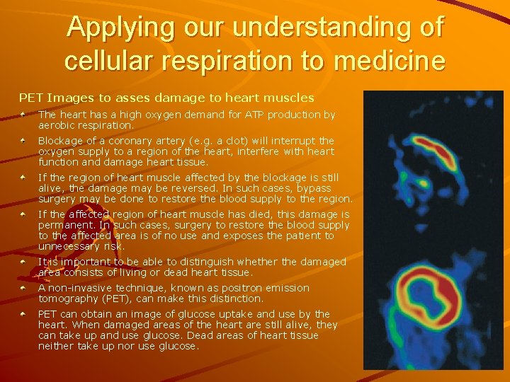 Applying our understanding of cellular respiration to medicine PET Images to asses damage to