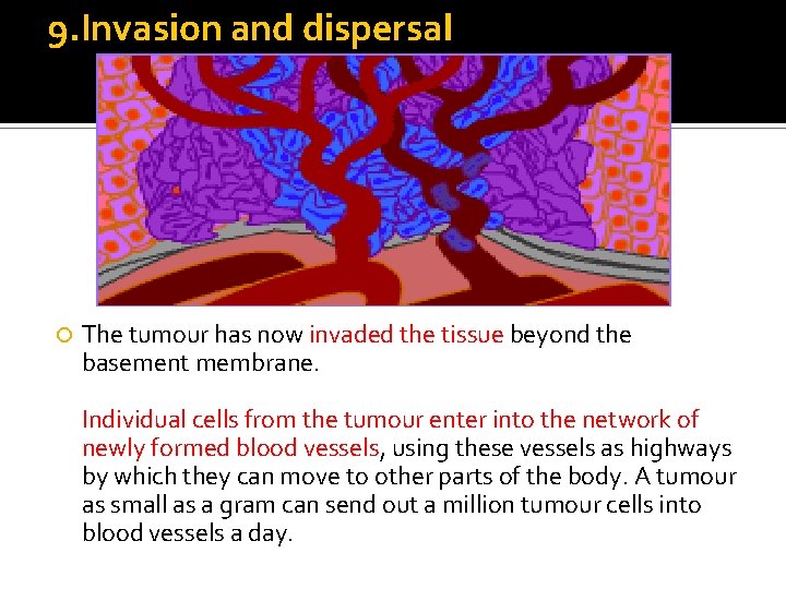9. Invasion and dispersal The tumour has now invaded the tissue beyond the basement