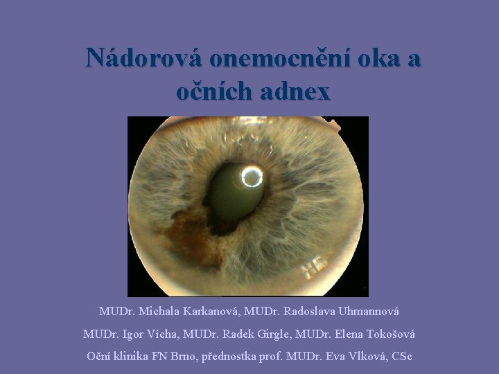 Nádorová onemocnění oka a očních adnex MUDr. Michala Karkanová, MUDr. Radoslava Uhmannová MUDr. Igor