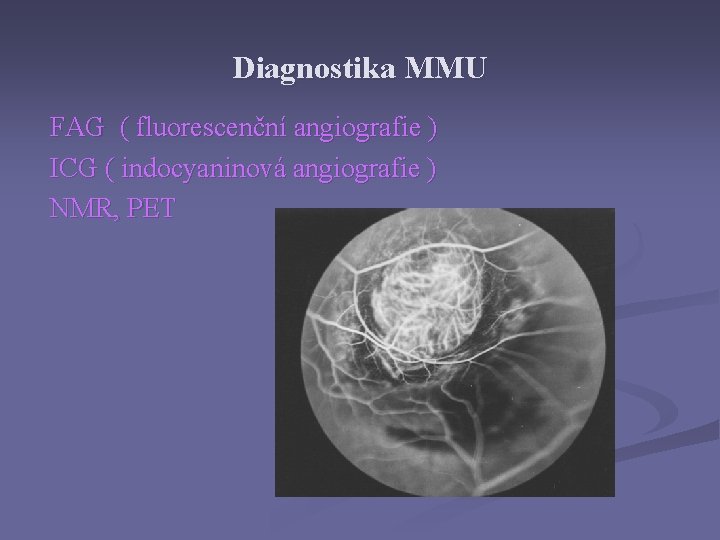 Diagnostika MMU FAG ( fluorescenční angiografie ) ICG ( indocyaninová angiografie ) NMR, PET