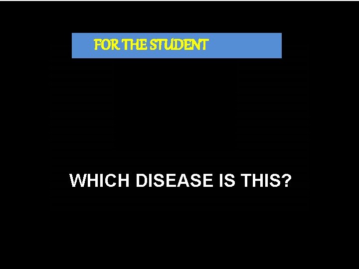FOR THE STUDENT WHICH DISEASE IS THIS? Which disease is this? 