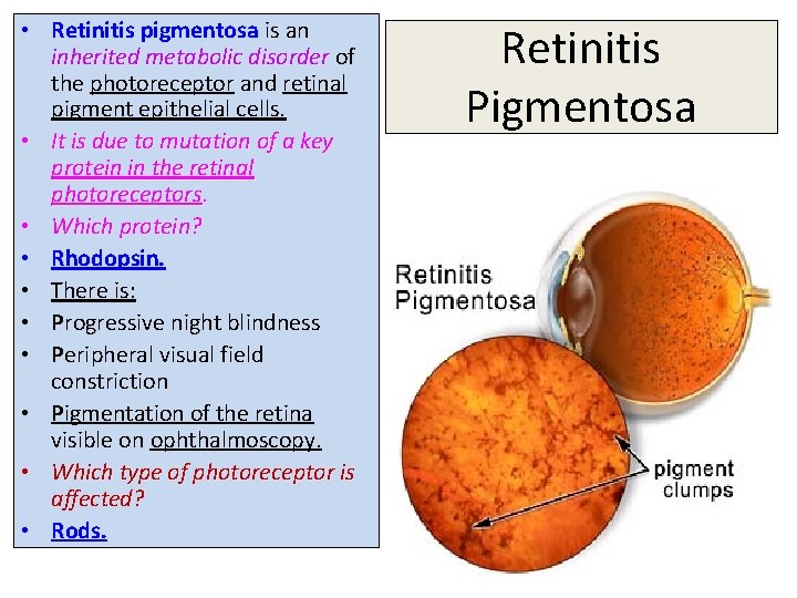  • Retinitis pigmentosa is an inherited metabolic disorder of the photoreceptor and retinal