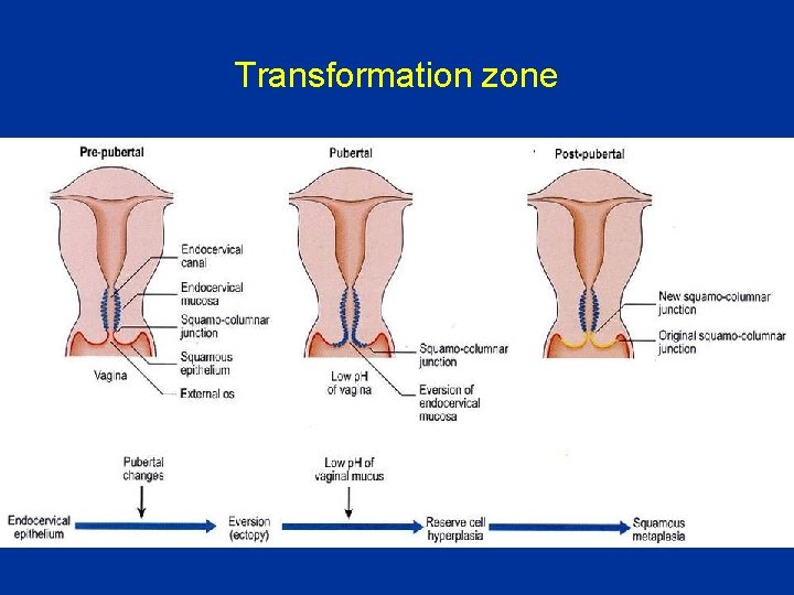Transformation zone 