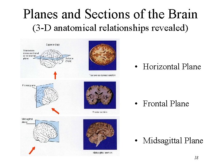 Planes and Sections of the Brain (3 -D anatomical relationships revealed) • Horizontal Plane