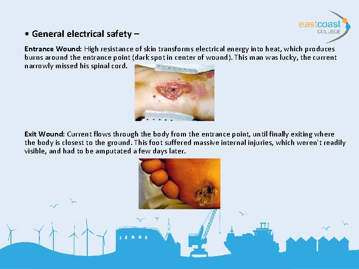  • General electrical safety – Entrance Wound: High resistance of skin transforms electrical