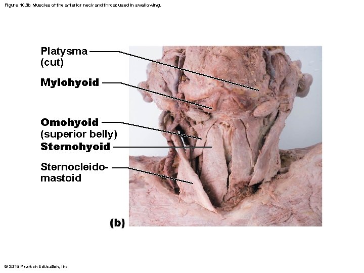 Figure 10. 9 b Muscles of the anterior neck and throat used in swallowing.