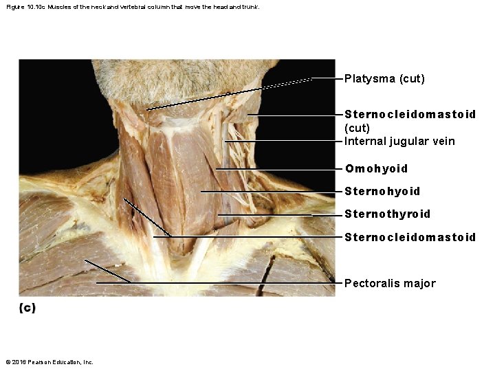 Figure 10. 10 c Muscles of the neck and vertebral column that move the