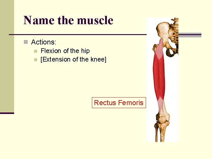 Name the muscle n Actions: n Flexion of the hip n [Extension of the