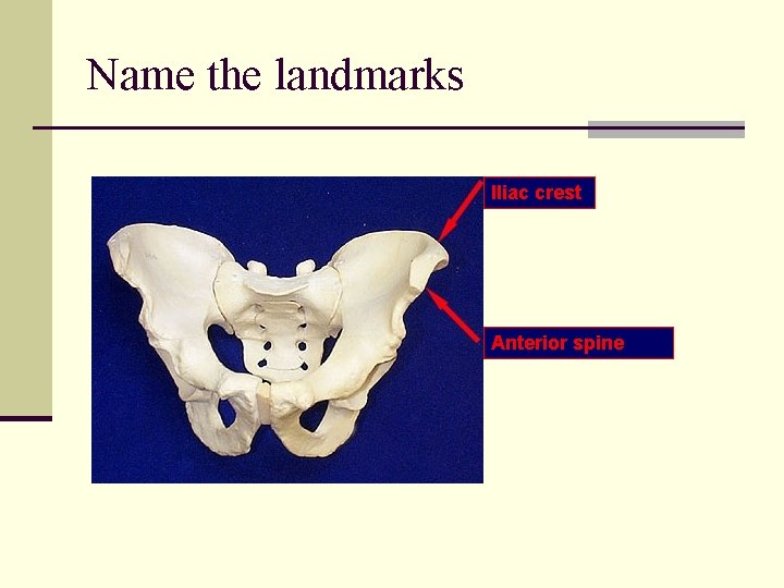 Name the landmarks Iliac crest Anterior spine 