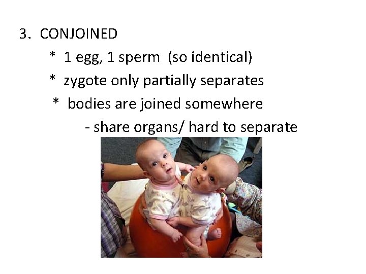 3. CONJOINED * 1 egg, 1 sperm (so identical) * zygote only partially separates