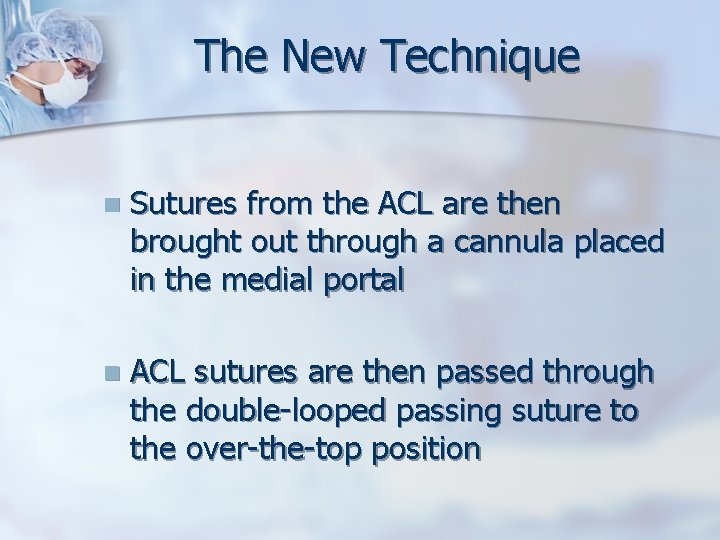 The New Technique n Sutures from the ACL are then brought out through a