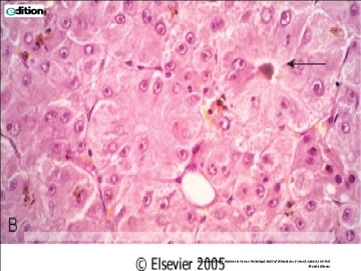 Downloaded from: Robbins & Cotran Pathologic Basis of Disease (on 9 March 2006 02: